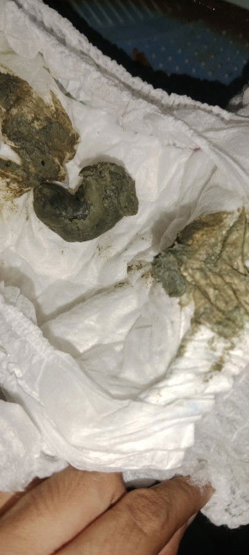 Anakku 15bulan lebih