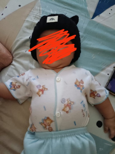 Bunda bunda maaf saya mau tanya apakah normal bayi umur 3 bulan perutnya buncit seperti ini