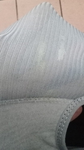 White discharge