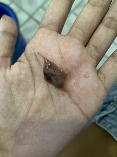 สอบถามแม่ๆหน่อยค่ะ