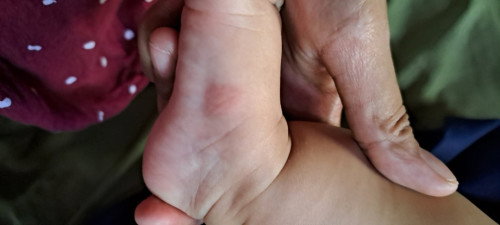Kulit bayi