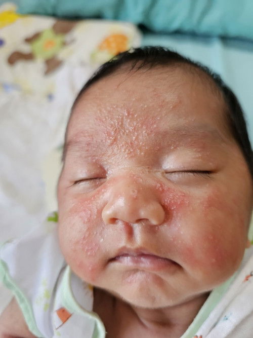 😭มันคืออะไรคะขึ้นที่หน้า