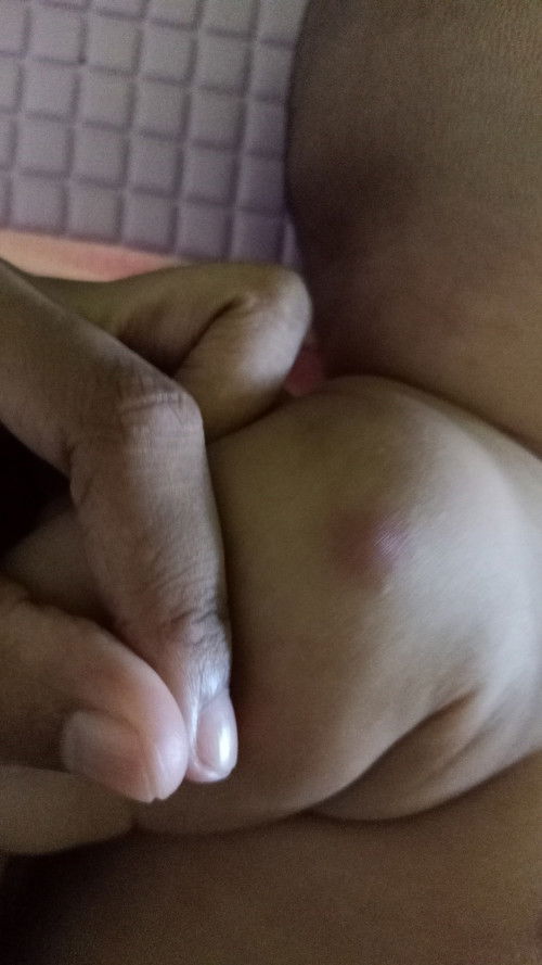 Siapa tau ada yg pernah ngalamin