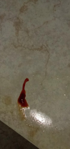 Hamil 6 minggu  ngflek 3hari ,  dikasih obat penguat kandungan  Alhamdulillah flek nya udh 8hari