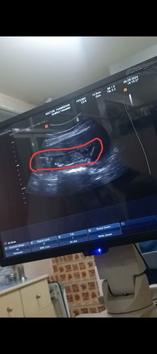 น้ำหนักลูก