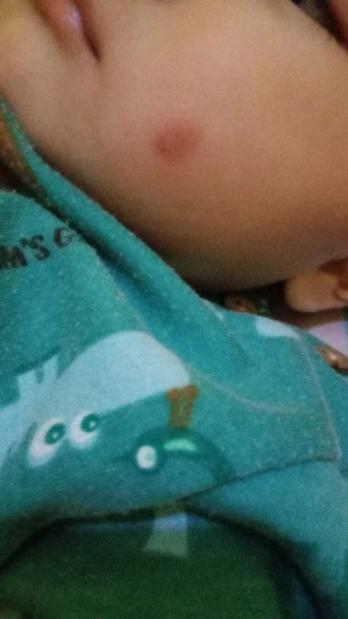 Bun ini kenapa ya bangun tidur ada begini di kulit bayi aku