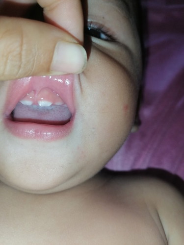 ลูก9เดือน10วันฟันขึ้นกันกี่ซี่