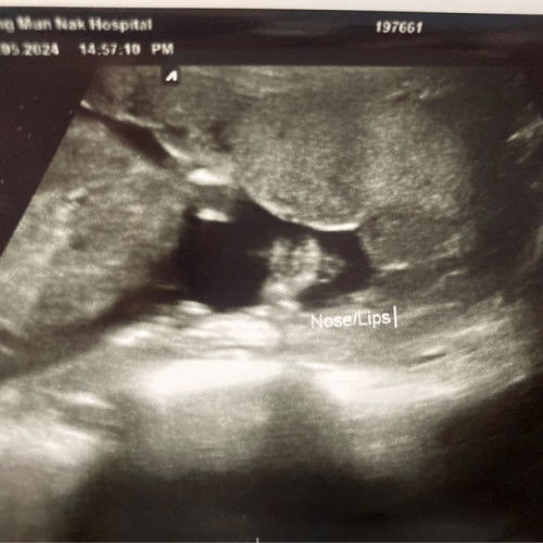 รูปตั้งแต่ตั้งท้อง4เดือน