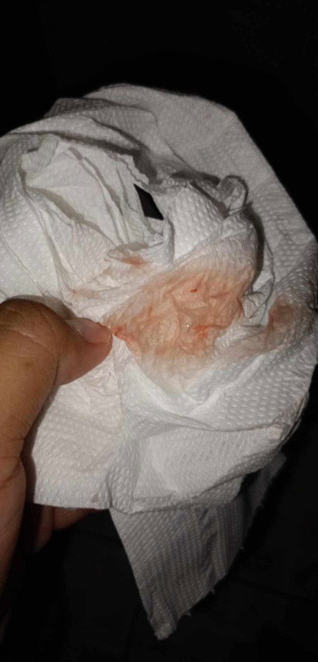 มีเลือกออก