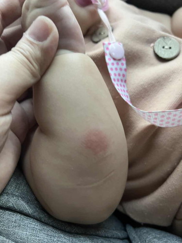 Hi mommies! Baby rashes lang ba ito?