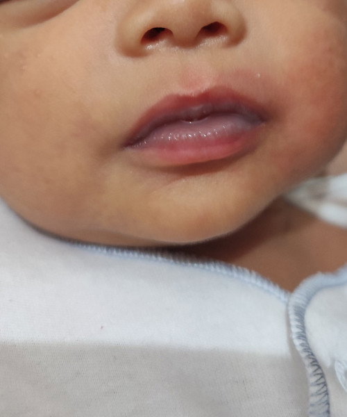 Bibir bayi warnanya gelap separo