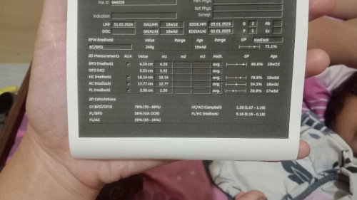 Hasil usg usianya beda beda- beda