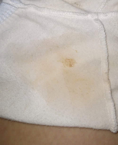 7 months pregnant po yan po nalabas sakin pagkatapos ko umihi