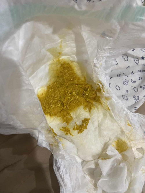 สอบถามเรื่องอึน้องค่ะ ขอโทษด้วนนะคะ ถ้าทานข้าวอยู่ รึไม่โอเค