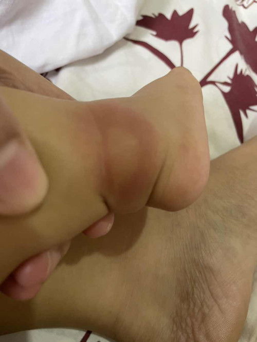 Kagat kaya ng ano ito