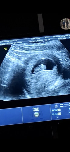 ขอสอบถามแม่ๆหน่อยค่ะ