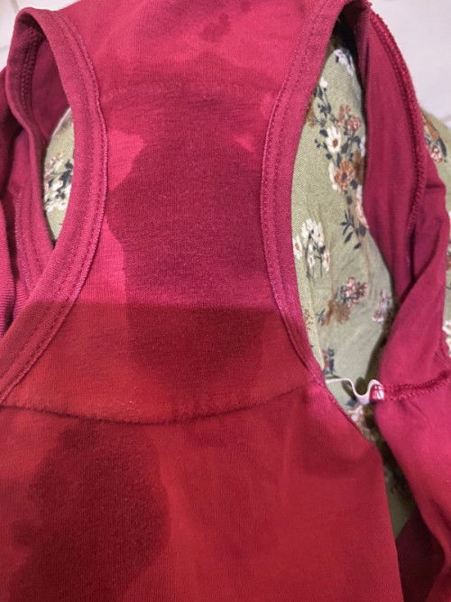 Keluar cairan bening