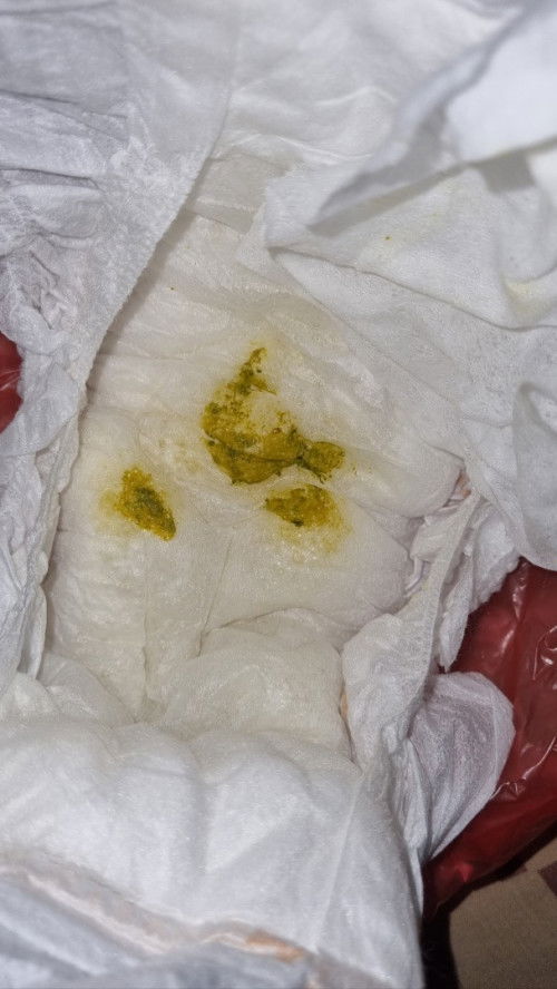 Warna pup bayi 2 bulan