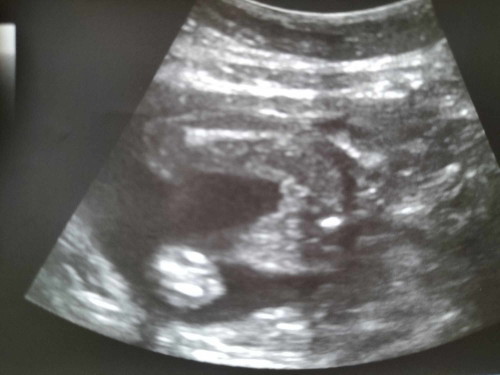 ตั้งครรภ์ ทีม เดือนธันวาคม