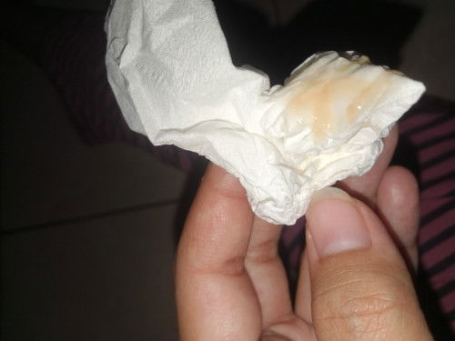 keputihan normal /tdk normal???
usia kehamilan 37weeks 6D