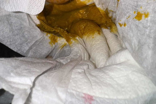 Beza poo cirit dan biasa newborn