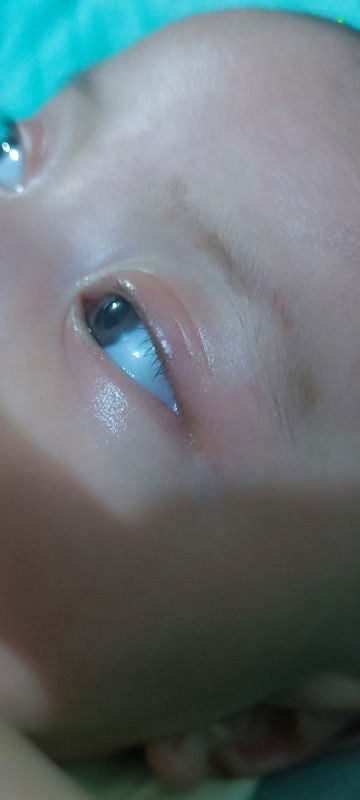 alis dan bulmat baby