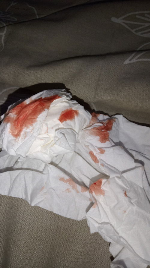 Bund aku keluar flek kaya gini