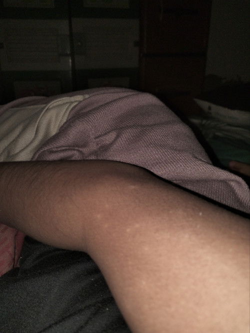 Warna kulit tidak merata