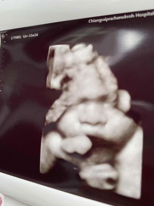 ไตรมาส 3 กับการบำรุงโปรตีน