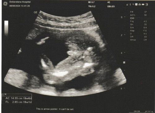 สอบถามเรื่องเพศลูก