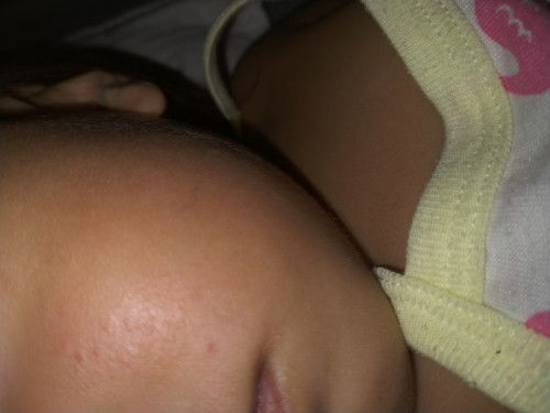 Something sa face ni baby