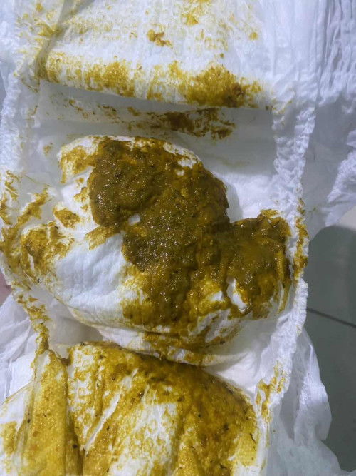 Pup bayi 6bulan 8hari ada serat hitam