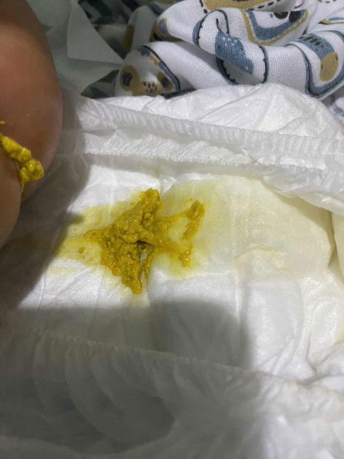 Bayi umur 5 hari apakah memang sering pup?