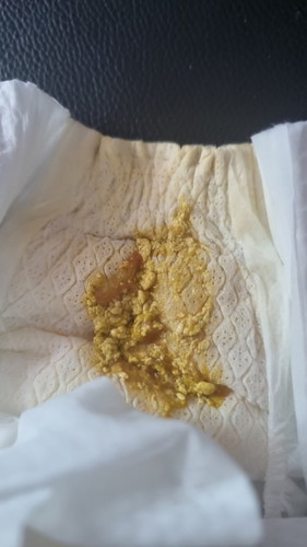 Babies poo