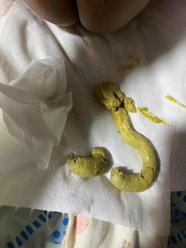 น้องอายุ2เดือน10วัน