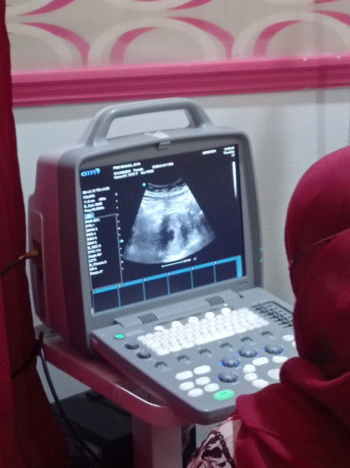 Hasil usg usia kandungan 7 minggu