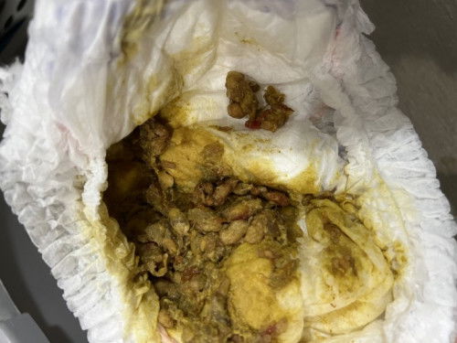 ลูก10เดือน ถ่ายปกติไหมค่ะ