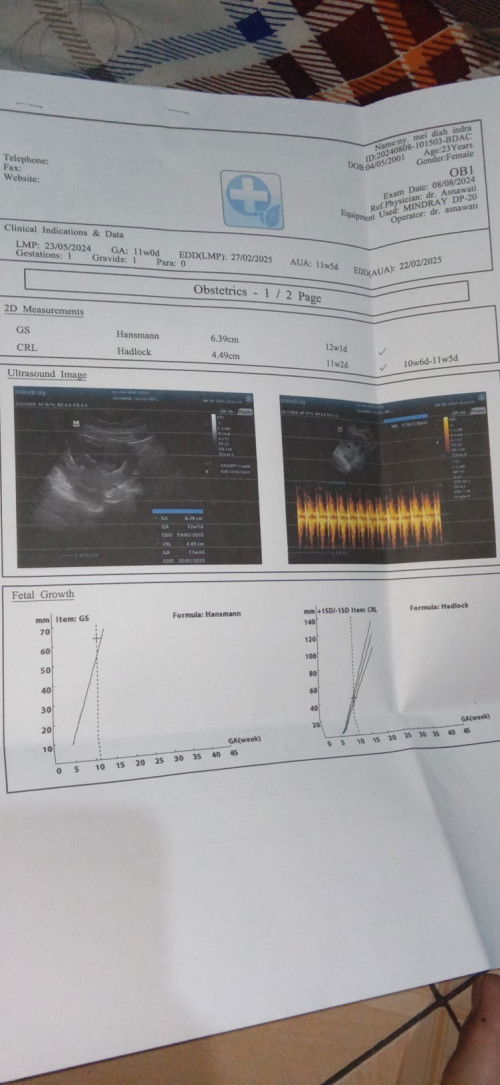 Bun mau tanya usia kehamilan ku 11 Minggu tadi saya usg dengan hasil kayak gitu 
Normal apa ya Bun☺️