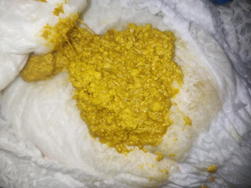 ถ่ายเป็นมูก