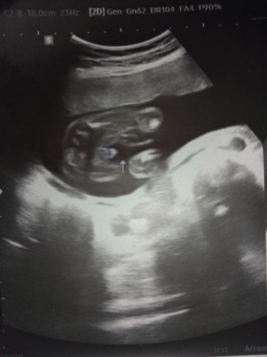 แบบนี้ผู้ชายใช่ไหมคะแม่ๆ