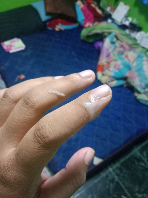 มูกหรือตกขาว