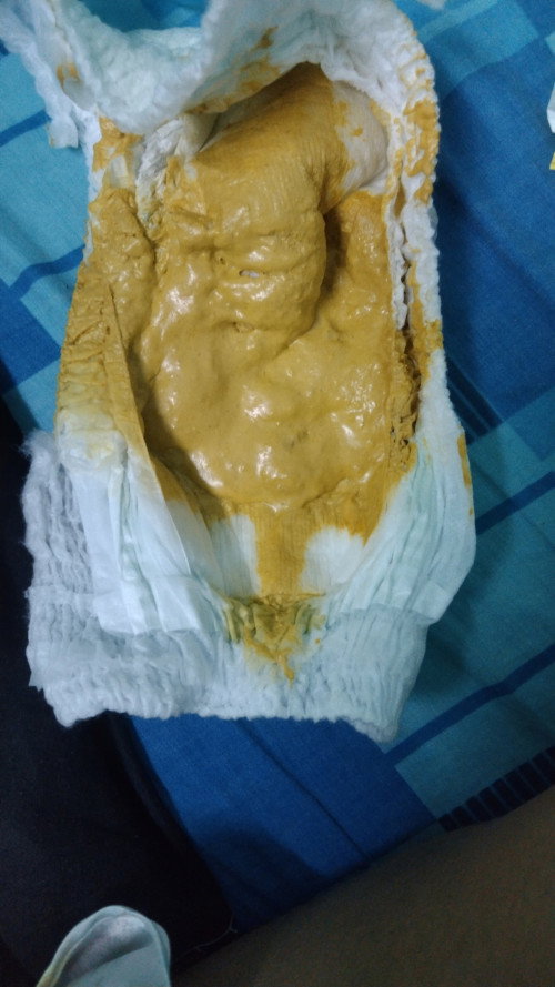 การขับถ่ายทารก