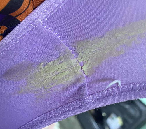 sering keputihan tm 3