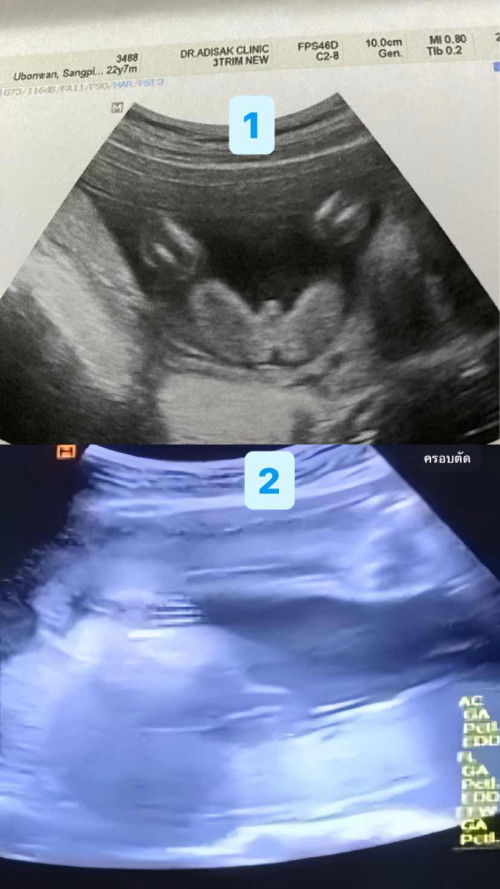 ไม่รู้น้องเพศไหนเลย หมอก็ไม่ชัวส์