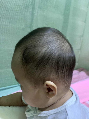 หัวแบนนนนนนนน