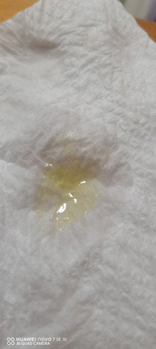 Keluar seperti di gambar.. Boleh tau nie ape ye.. Sy skg 36w 4d..tdi buang air ade nie skali..