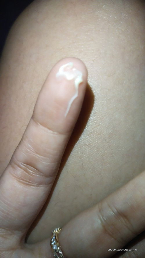 Keputihan berwarna putih