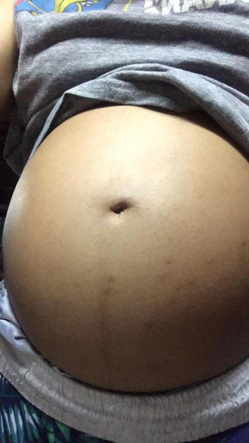 ท้องใหญ่ไปมั่ยคะท้องแรก