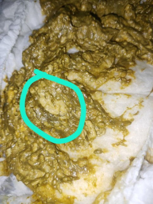 สอบถามแม่ๆค่