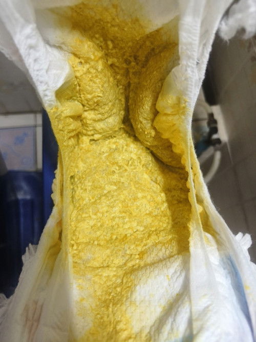 ลูกถ่ายแบบนี้ปกติไหมคะ #มีภาพ